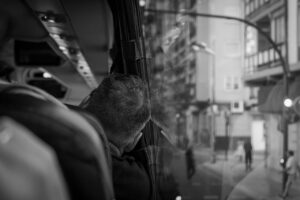 目元のむくみを予防するための効果的な対策は？
